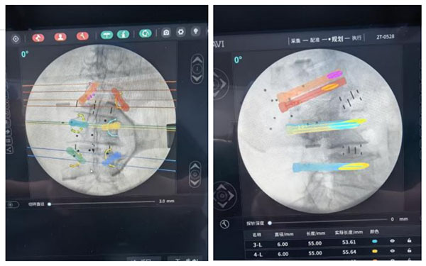 DM_20260403114143_002.jpg DM_20260403114143_002.jpg