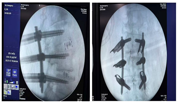 DM_20260403114143_003.jpg DM_20260403114143_003.jpg