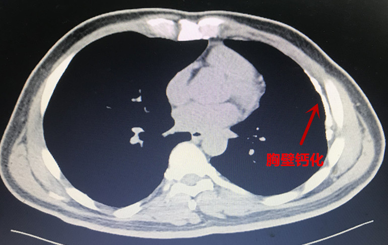 微信图片_20191217193917_副本